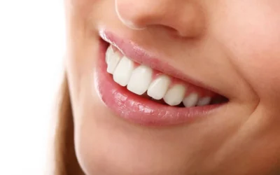Elimina la Sonrisa Gingival con Botox: La Solución Sofisticada para una Sonrisa Perfecta