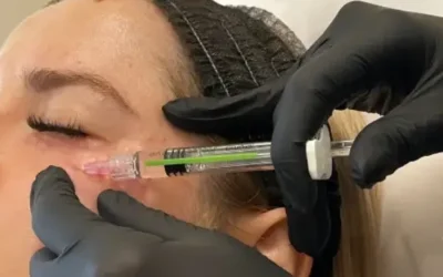 Polinucleótidos en Valencia: La nueva era del rejuvenecimiento cutáneo