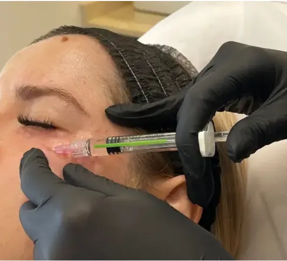 Polinucleótidos en Valencia: La nueva era del rejuvenecimiento cutáneo